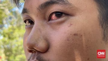 Dugaan Penganiayaan Pengendara di Jalan Bandara, Direskrimum Polda Sumbar Jadi Sorotan